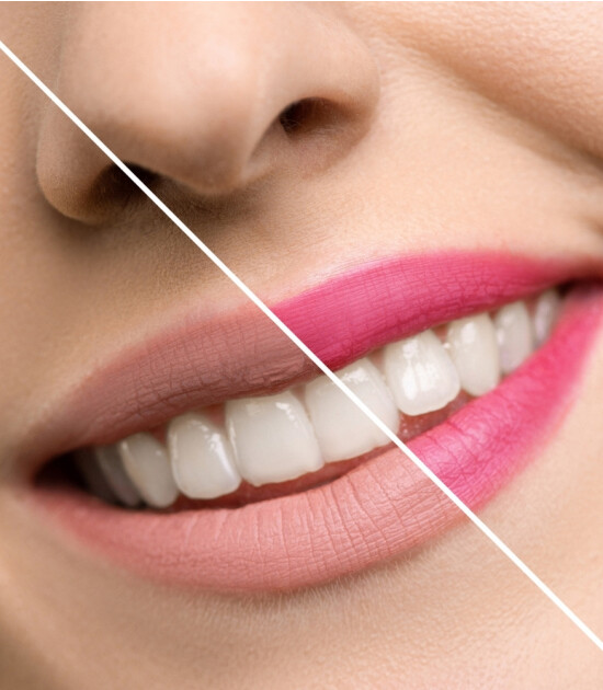 Inuwet Dudak Nemlendiricisi // Limonlu