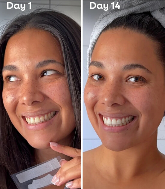 The Humble Co. Diş Beyazlatma Bandı // Nane