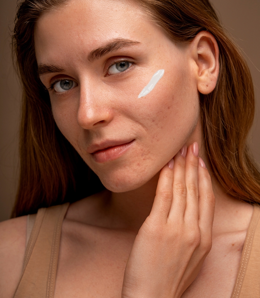 Minela Care 100% Organik Mineral Filtreli Akneye Meyilli Ciltler i&ccedil;in G&uuml;neş Kremi (50 SPF)